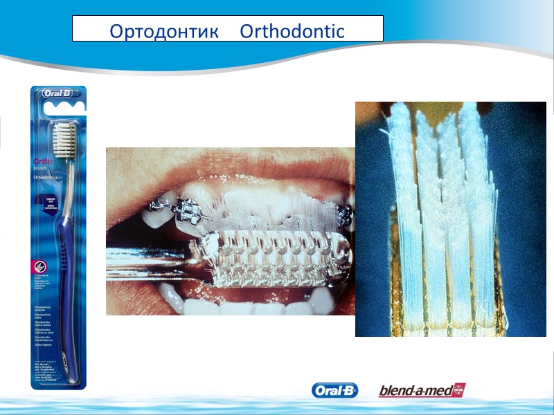 Ортодонтик    Orthodontic
